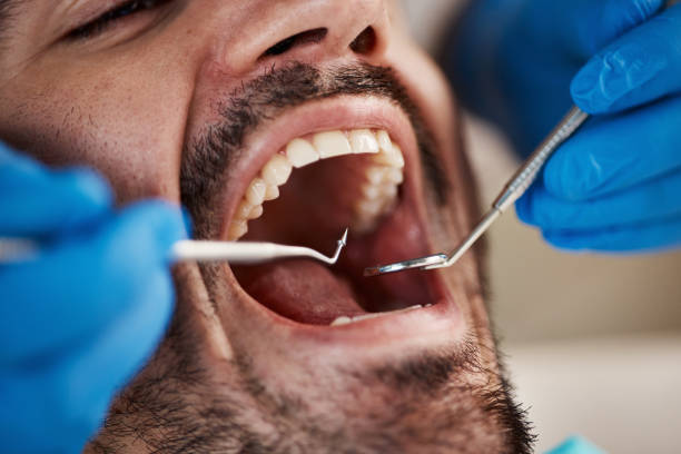 Best Emergency Treatment for Dental Infections or Abscesses in Collingdale, PA